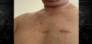 Bu Yaralar Sadece Bedende Değil, Hukuk Devletinde Açılmıştır!